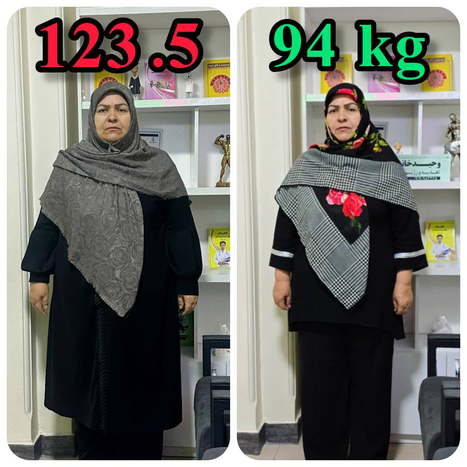 اسلیو معده بدون جراحی
