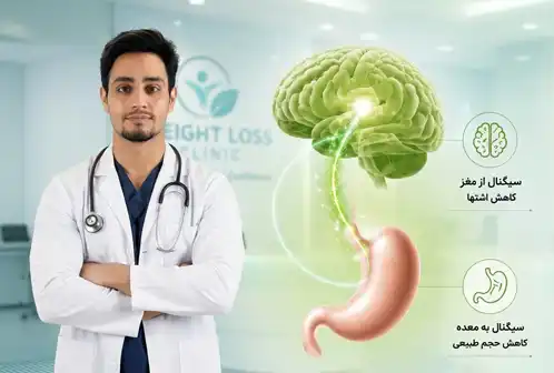اسلیو معده بدون