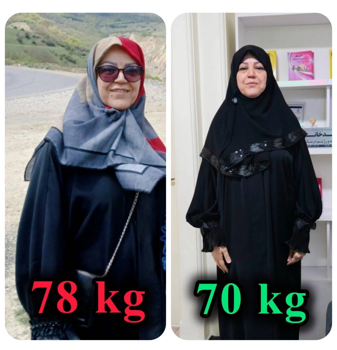 لاغری بدون جراحی در سنین بالا