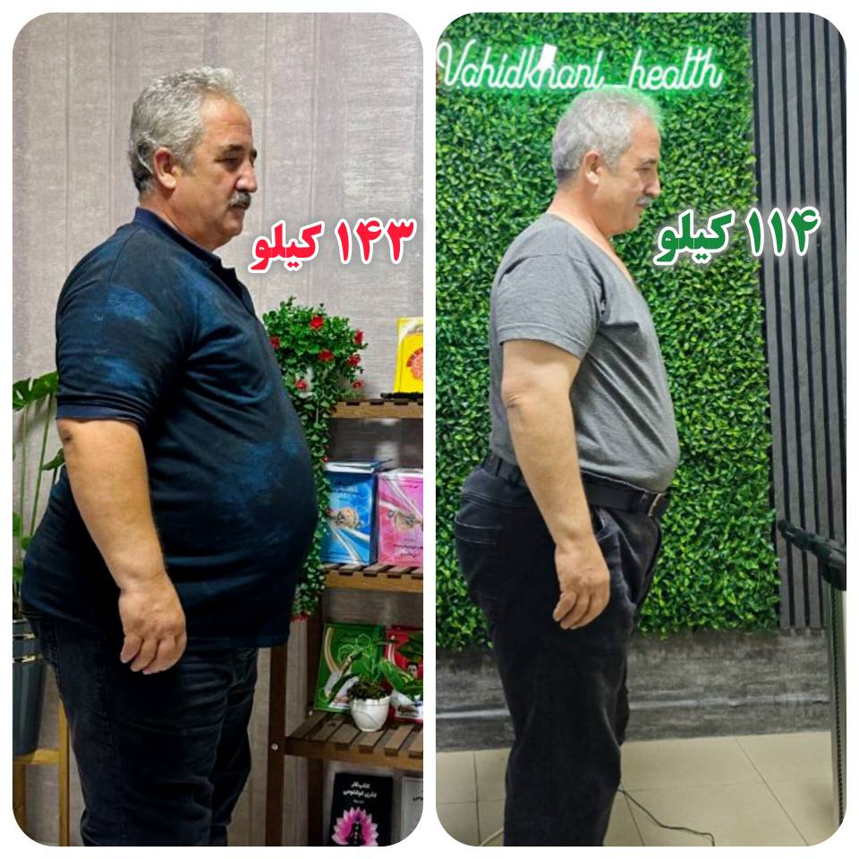 کاهش وزن 30 کیلویی