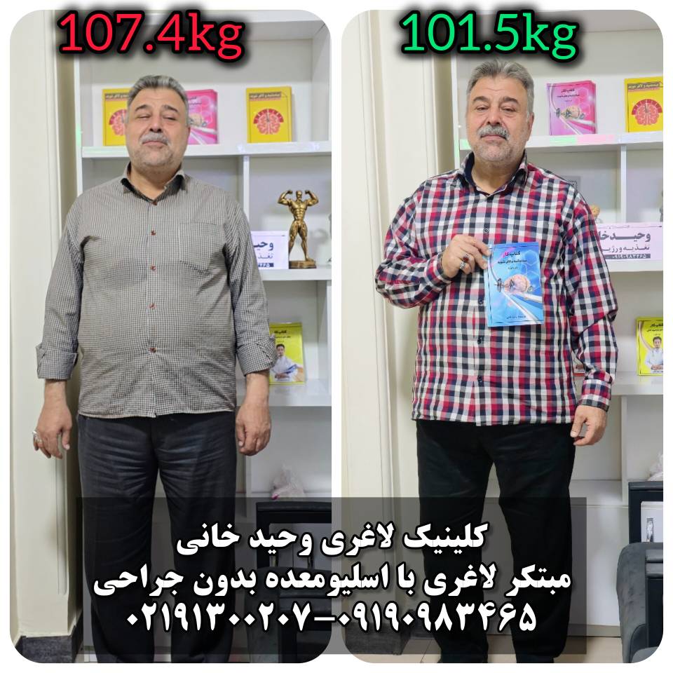 کاهش وزن 5 کیلوگرمی با روش غیر جراحی