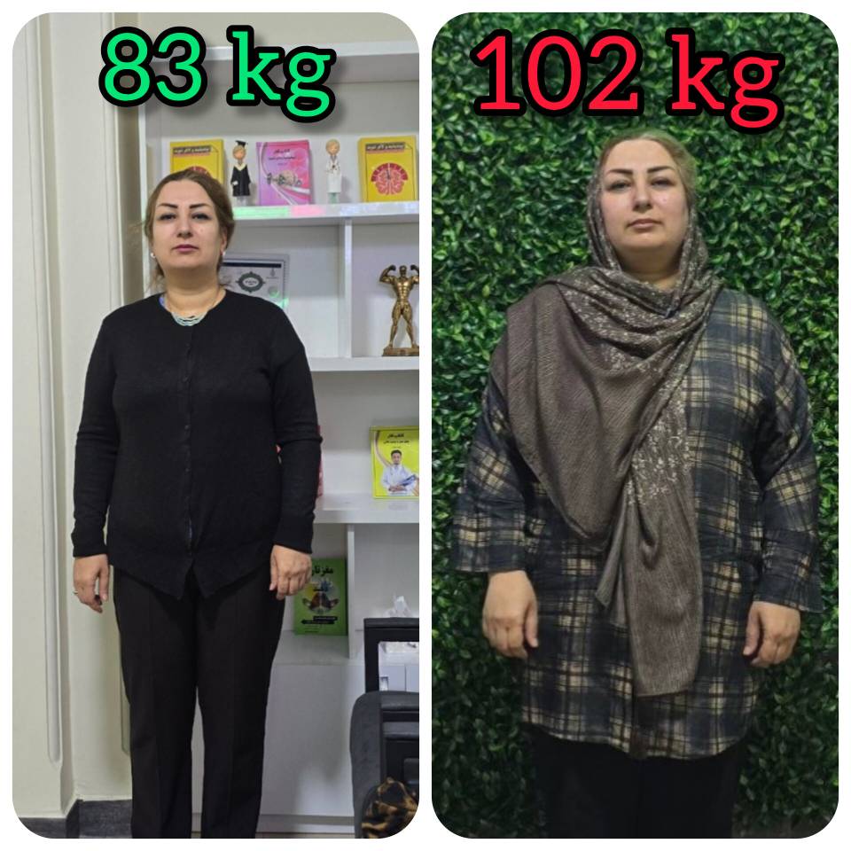 تاثیر کاهش وزن بر زانو و کمر
