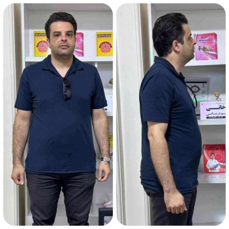 لاغری بدون رژیم سخت در یک ماه