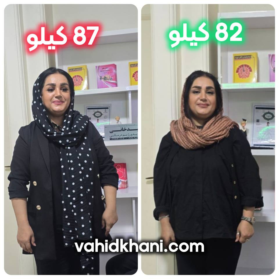 🌟 تحول خانم دلدار؛ کاهش وزن ۵ کیلوگرمی با مسیر درمانی اصولی