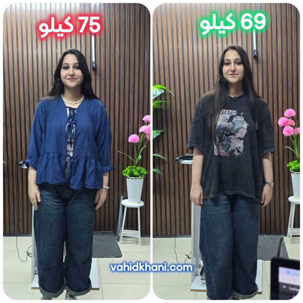 کاهش وزن اصولی و تغییر سایز چشمگیر؛ تجربه موفقیت مهیا کرمی با وزن ۷۵ کیلوگرم
