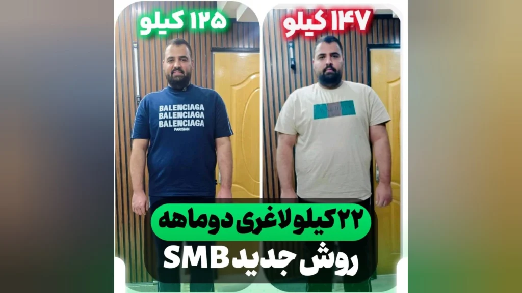لاغری سریع با اسلیو معده بدون جراحی آقای علیرضا محمدی با وزن 147 کیلو