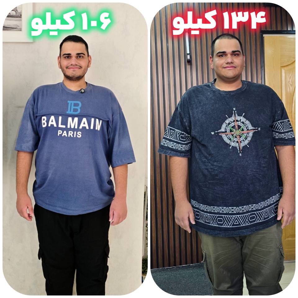 🌟 کاهش ۷ کیلوگرمی میثم در یک هفته؛ تجربه موفق اسلیو معده بدون جراحی