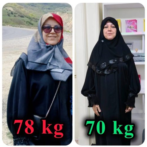 لاغری بدون جراحی در سنین بالا